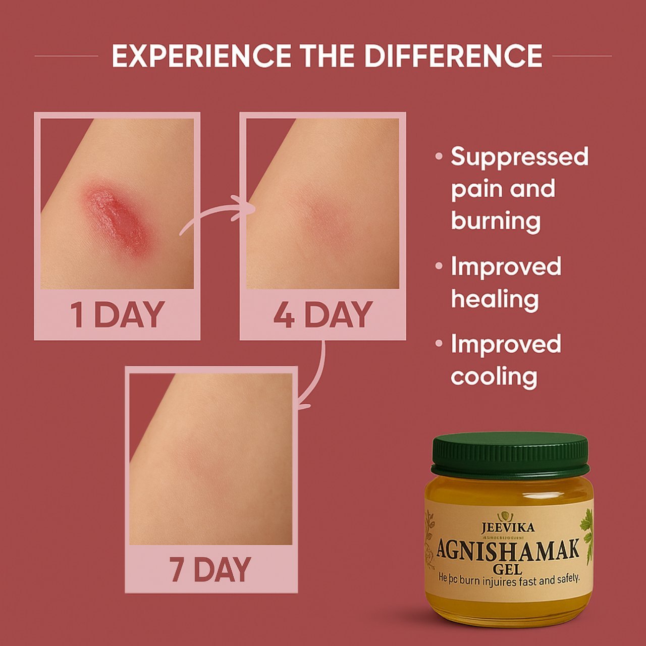 Agnishamak Gel - Jeevika Herbal